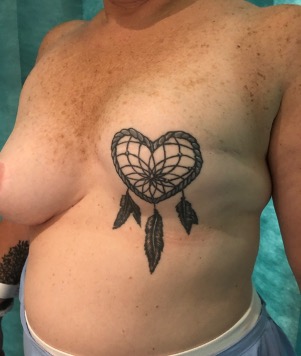 The Lymphoma Survival Tattoos I Got After My Recovery